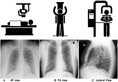 literature review on x ray